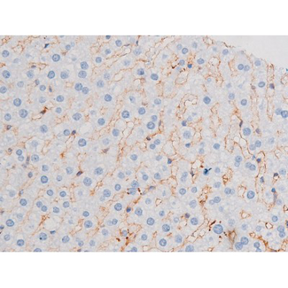 IRS1 Antibody - 1:200 staining rat liver tissue by IHC-P. The tissue was formaldehyde fixed and a heat mediated antigen retrieval step in citrate buffer was performed. The tissue was then blocked and incubated with the antibody for 1.5 hours at 22°C. An HRP conjugated goat anti-rabbit antibody was used as the secondary.