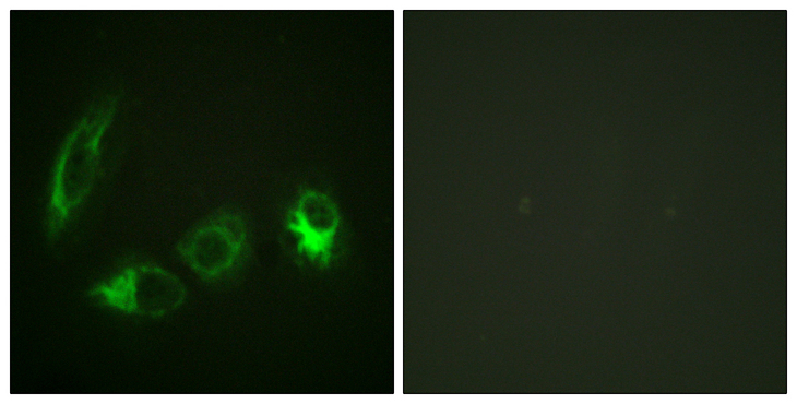 IRS1 Antibody - Immunofluorescence analysis of HeLa cells, using IRS-1 (Phospho-Ser323) Antibody. The picture on the right is blocked with the phospho peptide.