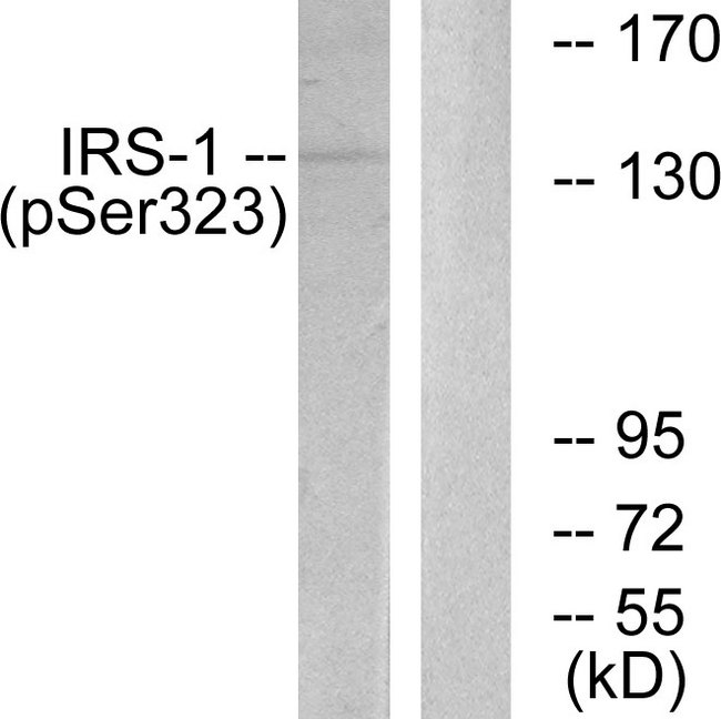 IRS1 Antibody - Western blot analysis of lysates from COS7 cells treated with Serum 20% 15', using IRS-1 (Phospho-Ser323) Antibody. The lane on the right is blocked with the phospho peptide.