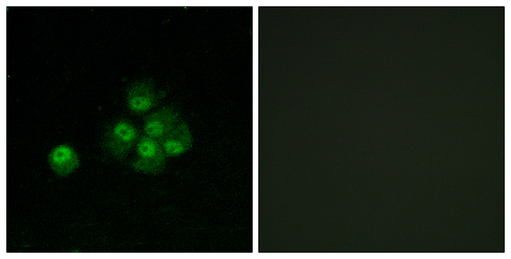 IRS1 Antibody - Immunofluorescence analysis of MCF7 cells, using IRS-1 (Phospho-Ser636) Antibody. The picture on the right is blocked with the phospho peptide.