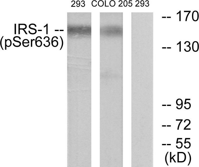 IRS1 Antibody - Western blot analysis of lysates from 293 cells and COLO205 cells, using IRS-1 (Phospho-Ser636) Antibody. The lane on the right is blocked with the phospho peptide.