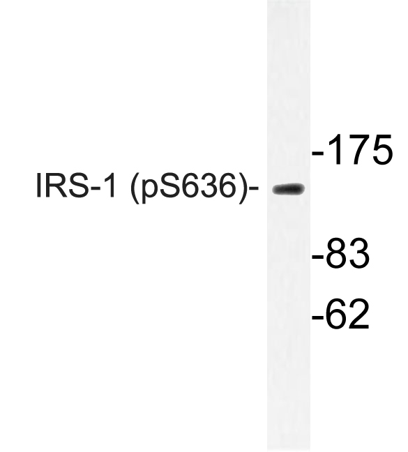 IRS1 Antibody - Western blot of p-IRS-1 (S636) pAb in extracts from COLO205 cells.