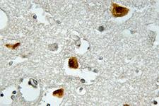 IRS1 Antibody - IHC of p-IRS-1 (S636) pAb in paraffin-embedded human brain tissue.