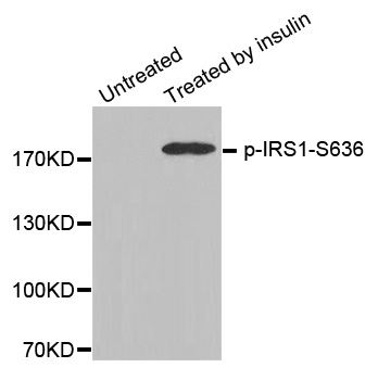 IRS1 Antibody - Western blot analysis of extracts from 3T3 cells.