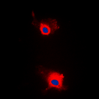 IRS1 Antibody - Immunofluorescent analysis of IRS1 (pS636) staining in MCF7 cells. Formalin-fixed cells were permeabilized with 0.1% Triton X-100 in TBS for 5-10 minutes and blocked with 3% BSA-PBS for 30 minutes at room temperature. Cells were probed with the primary antibody in 3% BSA-PBS and incubated overnight at 4 deg C in a humidified chamber. Cells were washed with PBST and incubated with a DyLight 594-conjugated secondary antibody (red) in PBS at room temperature in the dark. DAPI was used to stain the cell nuclei (blue).