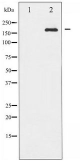 IRS1 Antibody - Western blot of IRS-1 phosphorylation expression in 293 whole cell lysates,The lane on the left is treated with the antigen-specific peptide.