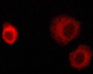 IRS1 Antibody - Staining MCF-7 cells by IF/ICC. The samples were fixed with PFA and permeabilized in 0.1% saponin prior to blocking in 10% serum for 45 min at 37°C. The primary antibody was diluted 1/400 and incubated with the sample for 1 hour at 37°C. A Alexa Fluor 594 conjugated goat polyclonal to rabbit IgG (H+L), diluted 1/600 was used as secondary antibody.