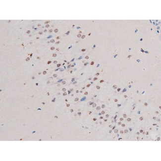 IRS1 Antibody - 1:200 staining mouse brain tissue by IHC-P. The tissue was formaldehyde fixed and a heat mediated antigen retrieval step in citrate buffer was performed. The tissue was then blocked and incubated with the antibody for 1.5 hours at 22°C. An HRP conjugated goat anti-rabbit antibody was used as the secondary.