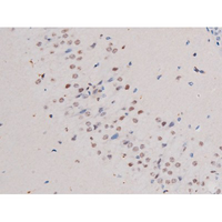 IRS1 Antibody - 1:200 staining mouse brain tissue by IHC-P. The tissue was formaldehyde fixed and a heat mediated antigen retrieval step in citrate buffer was performed. The tissue was then blocked and incubated with the antibody for 1.5 hours at 22°C. An HRP conjugated goat anti-rabbit antibody was used as the secondary.