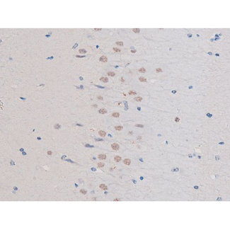 IRS1 Antibody - 1:200 staining rat brain tissue by IHC-P. The tissue was formaldehyde fixed and a heat mediated antigen retrieval step in citrate buffer was performed. The tissue was then blocked and incubated with the antibody for 1.5 hours at 22°C. An HRP conjugated goat anti-rabbit antibody was used as the secondary.