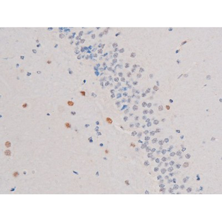 IRS1 Antibody - 1:200 staining rat brain tissue by IHC-P. The tissue was formaldehyde fixed and a heat mediated antigen retrieval step in citrate buffer was performed. The tissue was then blocked and incubated with the antibody for 1.5 hours at 22°C. An HRP conjugated goat anti-rabbit antibody was used as the secondary.