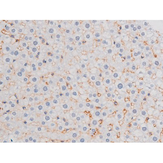 IRS1 Antibody - 1:200 staining rat liver tissue by IHC-P. The tissue was formaldehyde fixed and a heat mediated antigen retrieval step in citrate buffer was performed. The tissue was then blocked and incubated with the antibody for 1.5 hours at 22°C. An HRP conjugated goat anti-rabbit antibody was used as the secondary.