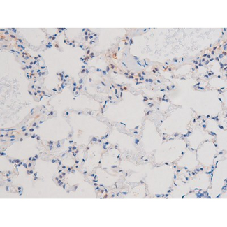 IRS1 Antibody - 1:200 staining rat lung tissue by IHC-P. The tissue was formaldehyde fixed and a heat mediated antigen retrieval step in citrate buffer was performed. The tissue was then blocked and incubated with the antibody for 1.5 hours at 22°C. An HRP conjugated goat anti-rabbit antibody was used as the secondary.