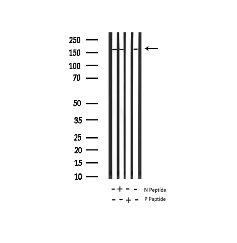 IRS1 Antibody - Western blot analysis of Phospho-IRS-1 (Ser639) using rat brain and mouse brain tissue extracts