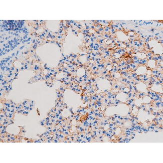 IRS1 Antibody - 1:200 staining mouse lung tissue by IHC-P. The tissue was formaldehyde fixed and a heat mediated antigen retrieval step in citrate buffer was performed. The tissue was then blocked and incubated with the antibody for 1.5 hours at 22°C. An HRP conjugated goat anti-rabbit antibody was used as the secondary.