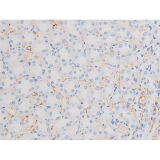 IRS1 Antibody - 1:200 staining rat kidney tissue by IHC-P. The tissue was formaldehyde fixed and a heat mediated antigen retrieval step in citrate buffer was performed. The tissue was then blocked and incubated with the antibody for 1.5 hours at 22°C. An HRP conjugated goat anti-rabbit antibody was used as the secondary.