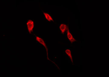 IRS1 Antibody - Staining COS7 cells by IF/ICC. The samples were fixed with PFA and permeabilized in 0.1% Triton X-100, then blocked in 10% serum for 45 min at 25°C. The primary antibody was diluted at 1:200 and incubated with the sample for 1 hour at 37°C. An Alexa Fluor 594 conjugated goat anti-rabbit IgG (H+L) Ab, diluted at 1/600, was used as the secondary antibody.