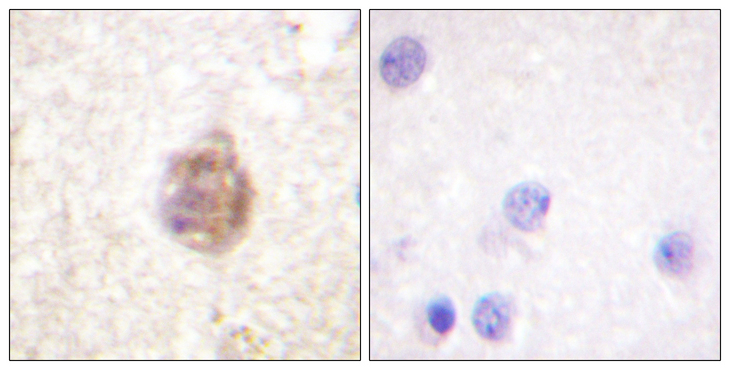 IRS1 Antibody - Immunohistochemistry analysis of paraffin-embedded human brain, using IRS-1 (Phospho-Ser794) Antibody. The picture on the right is blocked with the phospho peptide.