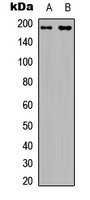 IRS1 Antibody - Western blot analysis of IRS1 (pS794) expression in HEK293T (A); rat muscle (B) whole cell lysates.