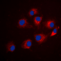 IRS1 Antibody - Immunofluorescent analysis of IRS1 (pS794) staining in HEK293T cells. Formalin-fixed cells were permeabilized with 0.1% Triton X-100 in TBS for 5-10 minutes and blocked with 3% BSA-PBS for 30 minutes at room temperature. Cells were probed with the primary antibody in 3% BSA-PBS and incubated overnight at 4 deg C in a humidified chamber. Cells were washed with PBST and incubated with a DyLight 594-conjugated secondary antibody (red) in PBS at room temperature in the dark. DAPI was used to stain the cell nuclei (blue).