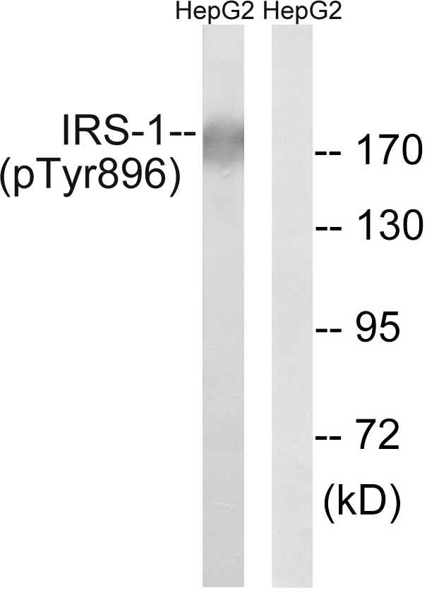 IRS1 Antibody - Western blot analysis of lysates from HepG2 cells treated with Na3VO4 0.3mM 40', using IRS-1 (Phospho-Tyr896) Antibody. The lane on the right is blocked with the phospho peptide.