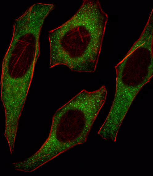 IRS2 / IRS-2 Antibody - Fluorescent image of HeLa cell stained with IRS2 Antibody. HeLa cells were fixed with 4% PFA (20 min), permeabilized with Triton X-100 (0.1%, 10 min), then incubated with IRS2 primary antibody (1:25, 1 h at 37°C). For secondary antibody, Alexa Fluor 488 conjugated donkey anti-rabbit antibody (green) was used (1:400, 50 min at 37°C). Cytoplasmic actin was counterstained with Alexa Fluor 555 (red) conjugated Phalloidin (7units/ml, 1 h at 37°C). IRS2 immunoreactivity is localized to Cytoplasm significantly.