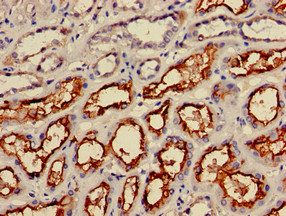 IRS2 / IRS-2 Antibody - Immunohistochemistry of paraffin-embedded human kidney tissue at dilution of 1:100
