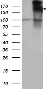 IRS2 / IRS-2 Antibody - HEK293T cells were transfected with the pCMV6-ENTRY control. (Left lane) or pCMV6-ENTRY IRS2. (Right lane) cDNA for 48 hrs and lysed