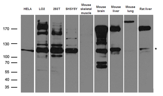 IRS2 / IRS-2 Antibody - Western blot analysis of extracts. (35ug) from different cell lines and tissues by using anti-IRS2 rabbit polyclonal antibody.