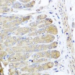 IRS2 / IRS-2 Antibody - Immunohistochemistry of paraffin-embedded mouse stomach using IRS2 antibody at dilution 1:100