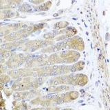 IRS2 / IRS-2 Antibody - Immunohistochemistry of paraffin-embedded mouse stomach using IRS2 antibody at dilution 1:100