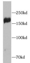 IRS2 / IRS-2 Antibody - Rat liver tissue were subjected to SDS PAGE followed by western blot with IRS2 antibody at dilution of 1:1000