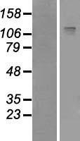 IRS2 / IRS-2 Protein - Western validation with an anti-DDK antibody * L: Control HEK293 lysate R: Over-expression lysate