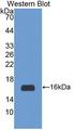 Irs3 Antibody - Western blot of Irs3 antibody.