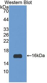 Irs3 Antibody - Western blot of Irs3 antibody.