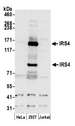 IRS4 Antibody - Detection of human IRS4 by western blot. Samples: Whole cell lysate (50 µg) from HeLa, HEK293T, and Jurkat cells prepared using NETN lysis buffer. Antibody: Affinity purified rabbit anti-IRS4 antibody used for WB at 0.1 µg/ml. Detection: Chemiluminescence with an exposure time of 30 seconds.
