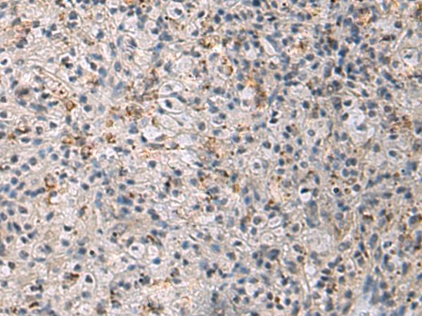 IRS4 Antibody - Immunohistochemistry of paraffin-embedded Human brain tissue  using IRS4 Polyclonal Antibody at dilution of 1:45(×200)