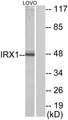 IRX1 Antibody - Western blot analysis of lysates from LOVO cells, using IRX1 Antibody. The lane on the right is blocked with the synthesized peptide.
