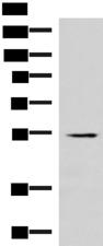 IRX1 Antibody - Western blot analysis of Human heart tissue lysate  using IRX1 Polyclonal Antibody at dilution of 1:300