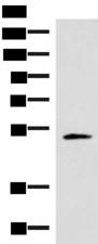 IRX1 Antibody - Western blot analysis of Human heart tissue lysate  using IRX1 Polyclonal Antibody at dilution of 1:400