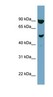 IRX2 Antibody - IRX2 antibody Western blot of NCI-H226 cell lysate. This image was taken for the unconjugated form of this product. Other forms have not been tested.