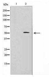 IRX2 Antibody - Western blot of 293 cell lysate using IRX2 Antibody