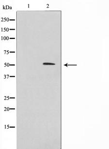 IRX2 Antibody - Western blot analysis on 293 cell lysates using IRX2 antibody. The lane on the left is treated with the antigen-specific peptide.