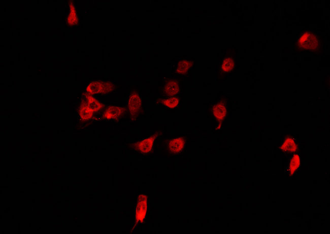 IRX2 Antibody - Staining 293 cells by IF/ICC. The samples were fixed with PFA and permeabilized in 0.1% Triton X-100, then blocked in 10% serum for 45 min at 25°C. The primary antibody was diluted at 1:200 and incubated with the sample for 1 hour at 37°C. An Alexa Fluor 594 conjugated goat anti-rabbit IgG (H+L) Ab, diluted at 1/600, was used as the secondary antibody.
