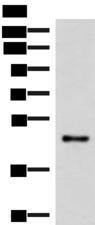 IRX2 Antibody - Western blot analysis of Mouse lung tissue lysate  using IRX2 Polyclonal Antibody at dilution of 1:300