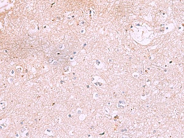 IRX2 Antibody - Immunohistochemistry of paraffin-embedded Human brain tissue  using IRX2 Polyclonal Antibody at dilution of 1:45(×200)