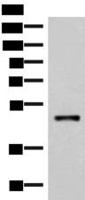 IRX2 Antibody - Western blot analysis of Mouse lung tissue lysate  using IRX2 Polyclonal Antibody at dilution of 1:300