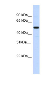 IRX3 Antibody - IRX3 antibody Western blot of Fetal liver lysate. This image was taken for the unconjugated form of this product. Other forms have not been tested.