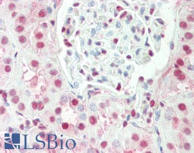 IRX3 Antibody - Human Kidney: Formalin-Fixed, Paraffin-Embedded (FFPE).  This image was taken for the unconjugated form of this product. Other forms have not been tested.