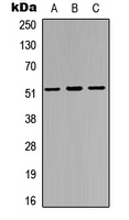 IRX3 Antibody - Western blot analysis of IRX3 expression in HEK293T (A); PC12 (B); HeLa (C) whole cell lysates.